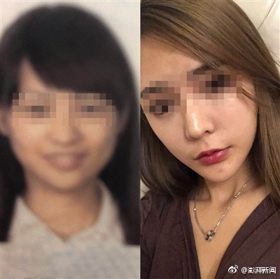 張女士坦承，於4年前曾做過醫美手術，「動過下巴」，因外貌與身分證差距過大，到機場安檢時被攔下而錯過班機。（圖擷取自《澎湃新聞》微博）