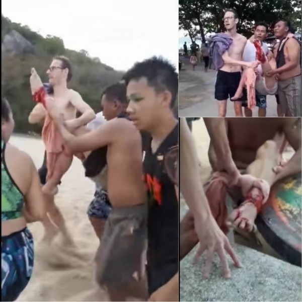 挪威男子在泰國遭到鯊魚攻擊，左腳血流不止，緊急送醫治療。（取自泰國網臉書）