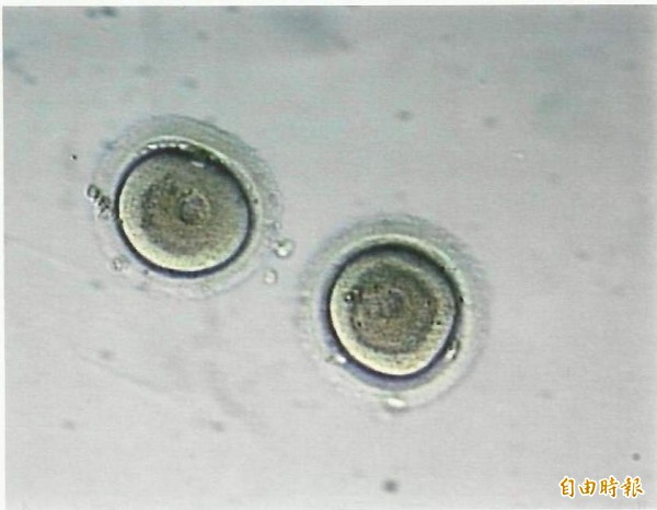 衛福部打算開放人工生殖機構技術員身分資格，未來獸醫學系、昆蟲系等科系的畢業生都可以成為人工生殖機構技術員。（資料照）