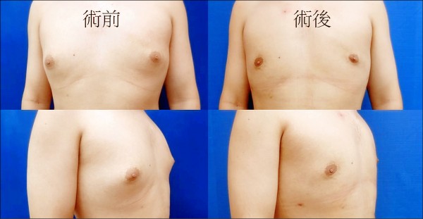 男同學有大咪咪遭另類校園霸凌 即時新聞 自由健康網