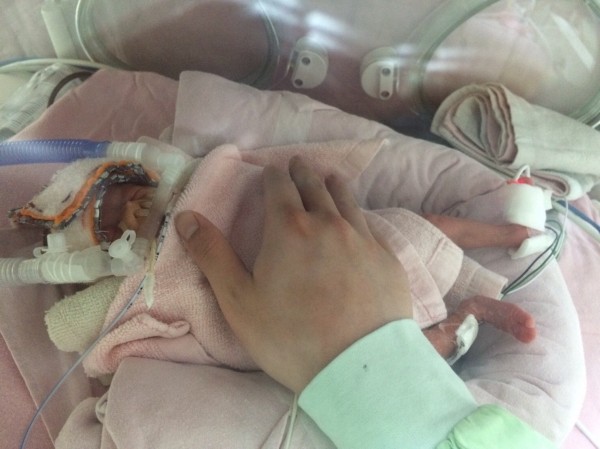 紅斑性狼瘡媽媽為保胎拚命女兒27週出生無併發症 即時新聞 自由健康網
