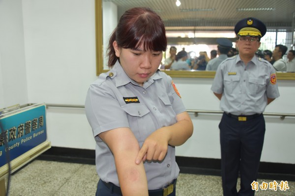 女警的手臂被咬傷。（記者葉永騫攝）