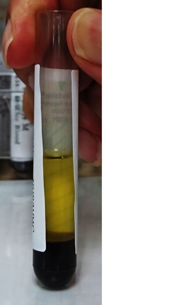 正常血液經離心處理後的樣子。(記者吳亮儀翻攝) 正常血液經離心處理後的樣子。(記者吳亮儀翻攝)