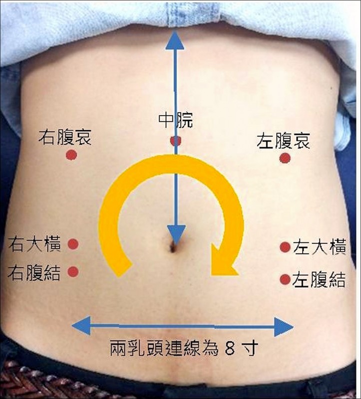 產後便秘分4類中醫對症通便 即時新聞 自由健康網