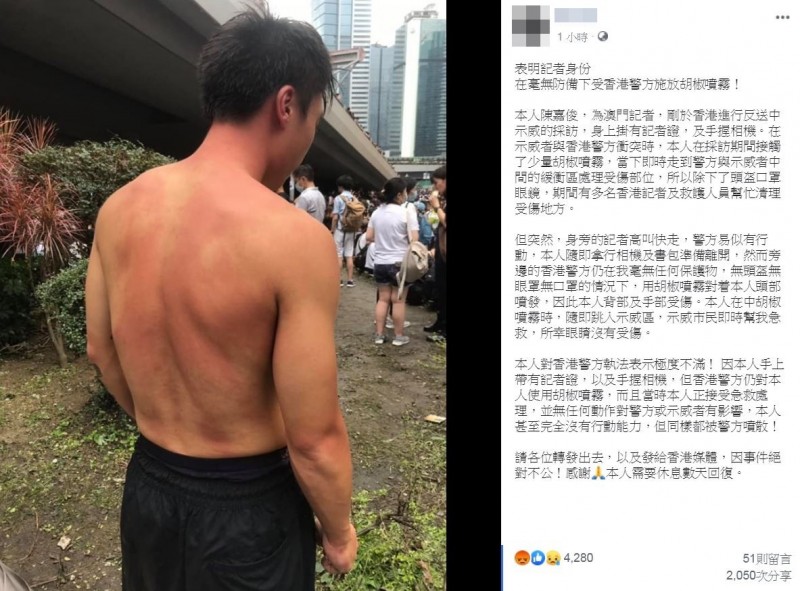 一名自稱為澳門記者的男子陳嘉俊，稍早在網路上發文透露，「剛於香港進行反送中示威的採訪」，並稱他有表明記者身分，卻仍在「毫無防備」下，被港警施放胡椒噴霧，對執法行為表達「極度不滿」。（圖翻攝自臉書）