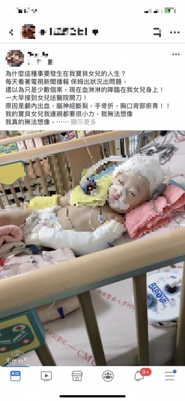 台中一名家長在臉書指控保母疑似虐嬰，1歲女兒嚴重腦傷目前仍昏迷不醒。（記者蔡淑媛翻攝自臉書）