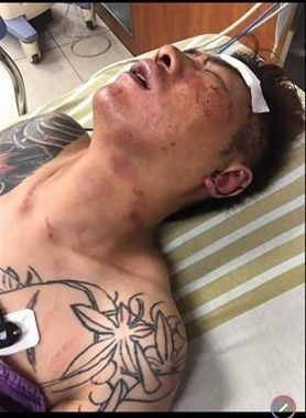 直播主吳小哲日前在屏東遭擄走，接著傳出他手腳斷掉被丟包公園，左腳可能有截肢風險。（記者陳彥廷翻攝）