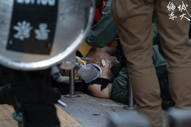 在荃灣大河道，下午4點多時有示威者遭實彈擊中左胸。（圖擷取自臉書＿香港城市大學學生會編輯委員會）