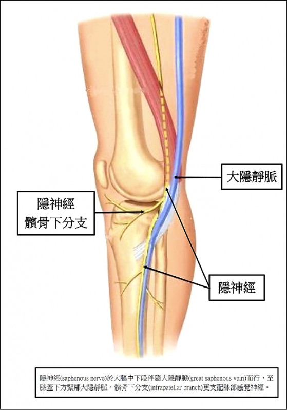 6旬婦膝脹痛難抬腿 靜脈曲張 惹禍 即時新聞 自由健康網