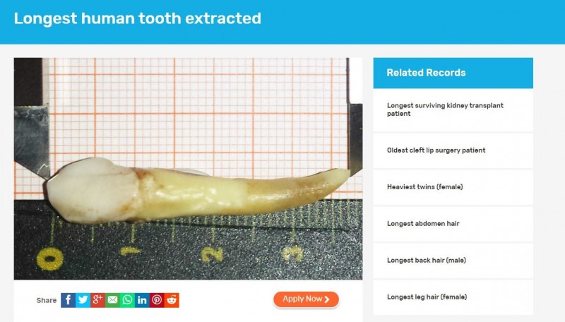 金氏世界紀錄認證3.7公分的牙齒為「人類最長牙齒」。（圖擷取自金氏世界紀錄網站）