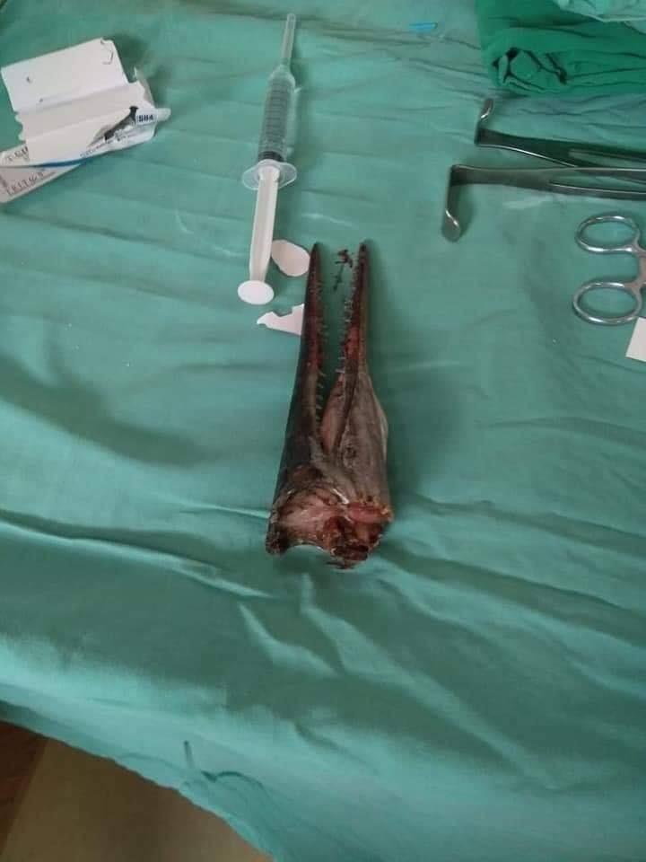 就是這尾圓尾頜針魚（Needlefish）戳穿了埃杜爾的脖子。（翻攝IFISH w TACKLEWORLD粉專）