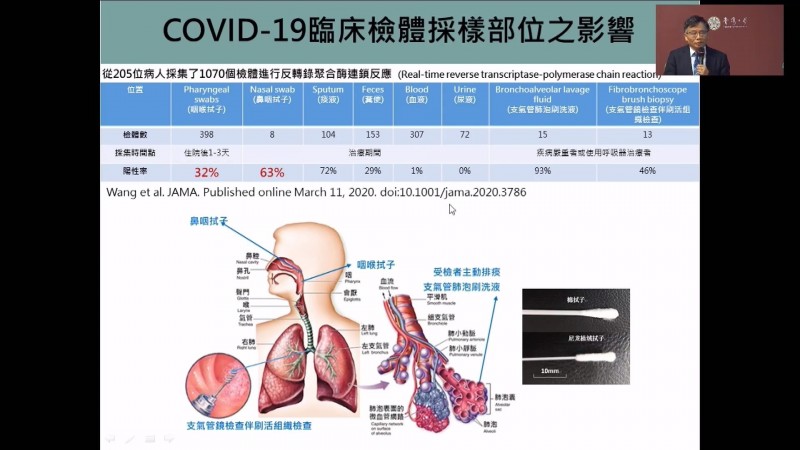 台灣大學公衛學院副院長陳秀熙點出，這次肺炎在臨床檢驗採樣上也須注意，如口腔採樣跟鼻腔採樣，確診結果就有差距，應建立統一標準。（記者吳柏軒翻攝）