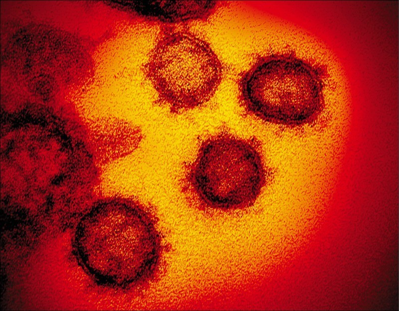 中國武漢爆發的新型冠狀病毒疾病（COVID-19，下稱武漢肺炎）疫情，持續在全球延燒。（歐新社）