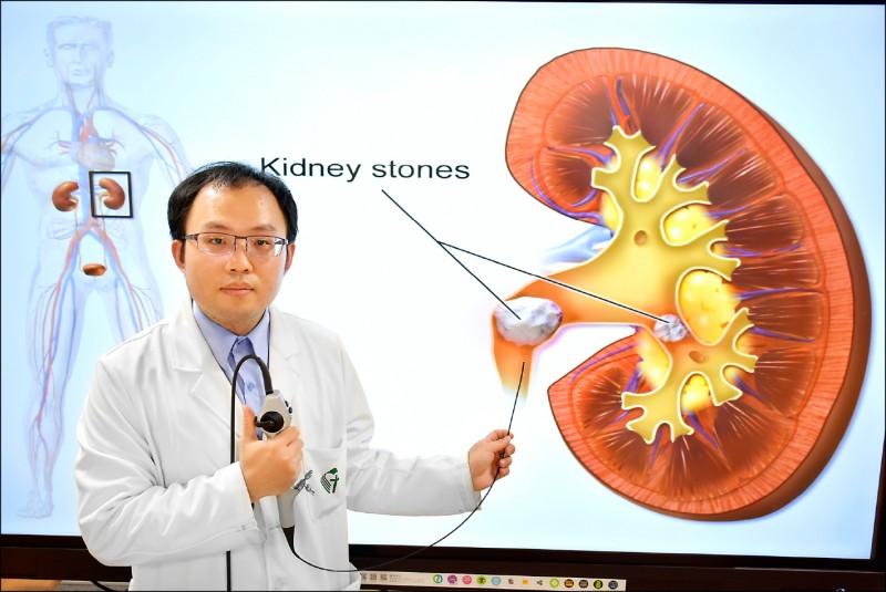 軟式輸尿管鏡 打結石無傷口隔天就出院 即時新聞 自由健康網