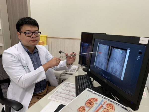 中國醫藥大學新竹附設醫院泌尿科醫師羅敏誠利用吳姓婦人的X光片，說明使用「迷你腎臟鏡碎石手術」術前、術後，她體內腎結石的大小變化。（記者黃美珠攝）