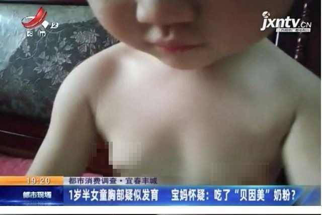 中國「毒奶粉」事件頻傳，近日江西省豐城市更出現，才1歲大的女嬰胸部竟然開始發育，醫生檢查後驚覺，奶粉可能有問題，要女嬰母親先把奶粉停掉。（圖擷取自百姓頭條）
