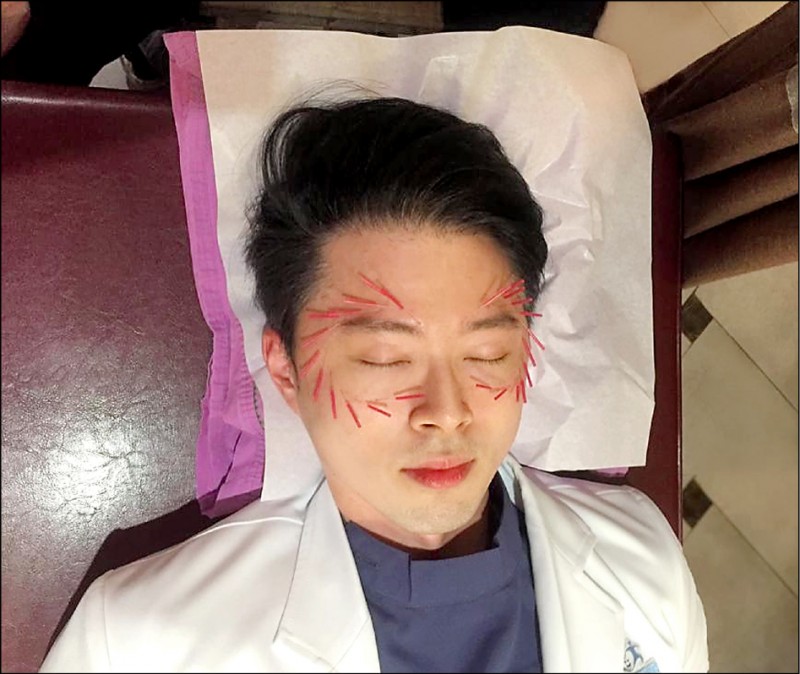皮膚老化氣色差 美顏針 溫和顧面子 即時新聞 自由健康網