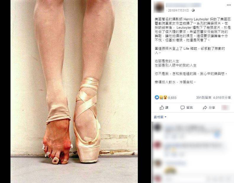 芭蕾女伶「裸足」勵志文瘋傳，實為圖文不符的杜撰故事。（圖擷取自查核中心網頁）