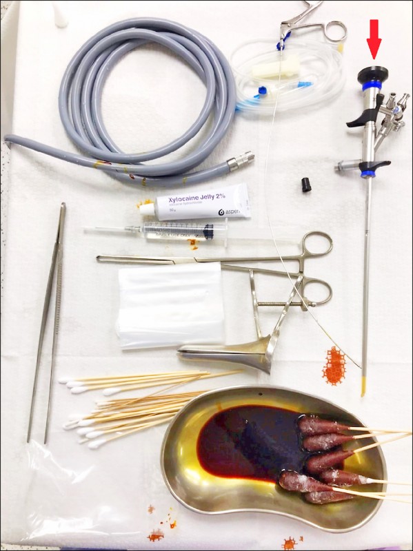 膀胱鏡檢查下泌尿道診斷利器 即時新聞 自由健康網