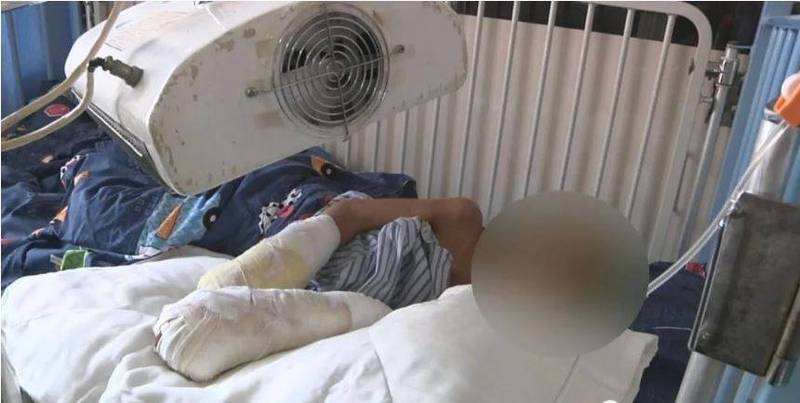 中國廣東省茂名市傳虐童案，7歲男童雙手嚴重燒傷，面臨截肢，虐待者疑為生父。（圖擷取自網路）