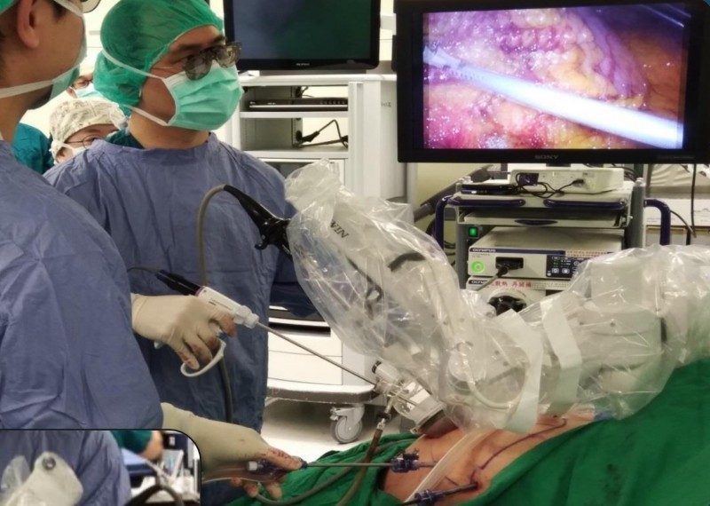 彭正明醫師指出，內視鏡扶持機器人為單臂機器手臂相對輕便，搭配單孔技術、3D影像系統等，提高手術的品質與安全性。（記者蔡淑媛翻攝）