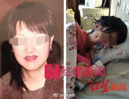中國女富商「高價抽脂」慘成植物人，10年後因缺血缺氧性腦病身亡，只因麻醉過量釀憾事。（圖取自微博）