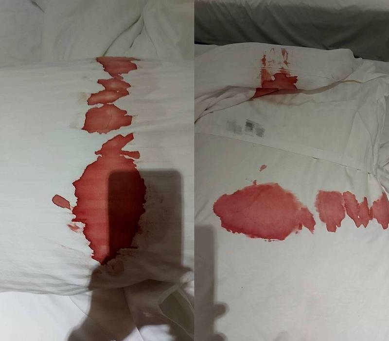 有飯店櫃台人員指出，近日遇到一名女房客退房後，房內的白色床單竟沾滿鮮血，連枕頭也無一倖免，讓她相當不滿。（圖擷取自臉書社團「爆怨公社」）