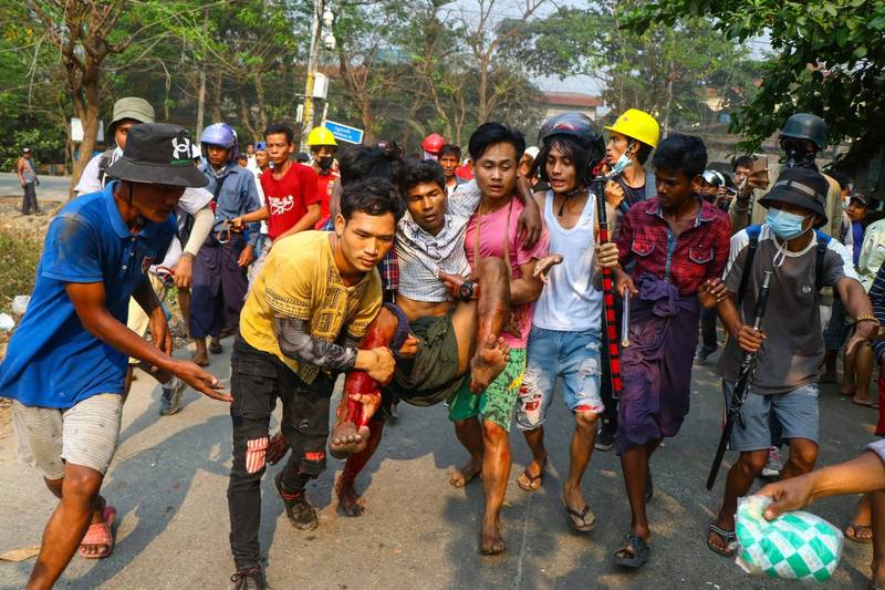 緬甸民眾抗議軍事政變遭遇最血腥的一日，仰光郊區的一間醫院傳出收到了34具遺體。圖為仰光民眾抬著傷患。（法新社）