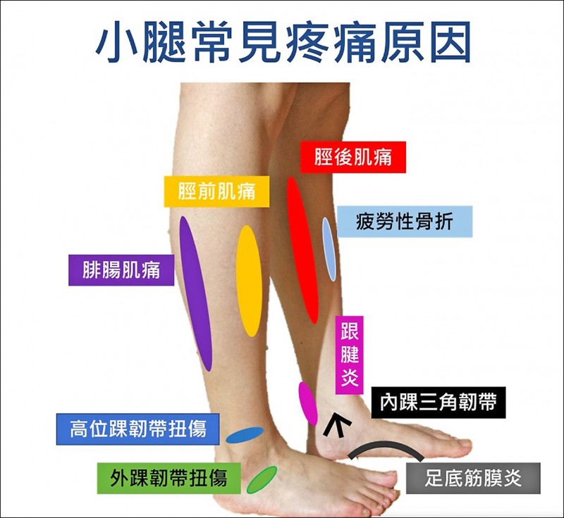 高位踝關節扭傷針灸 熱薰有效止痛 即時新聞 自由健康網