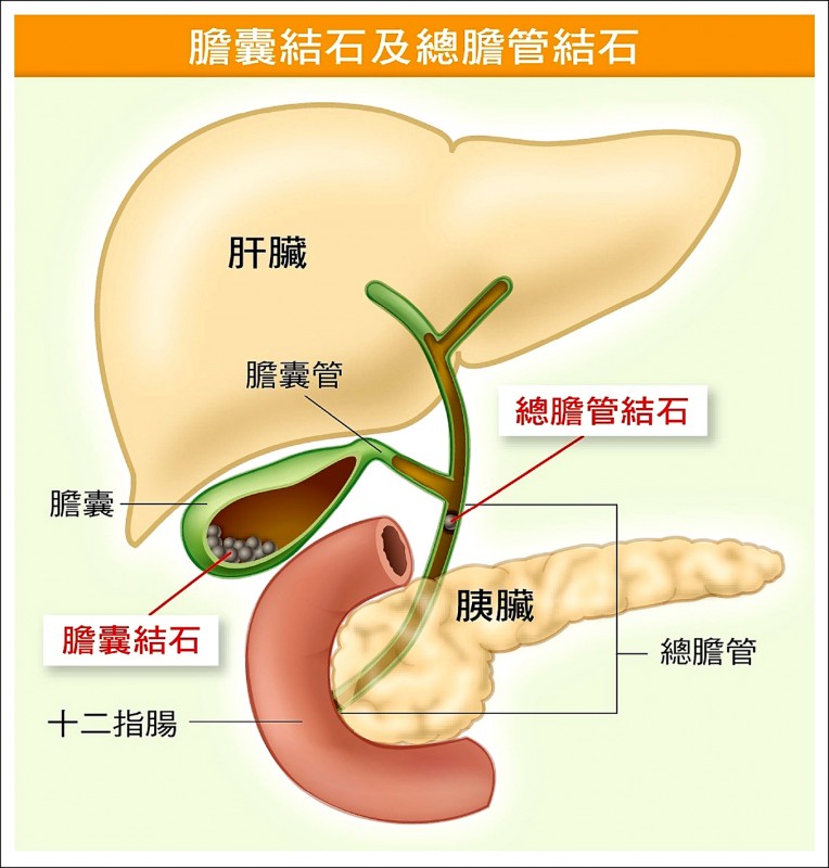 原因 尿 管 結石 尿路結石(尿管結石、腎臓結石、膀胱結石)の原因や治療について