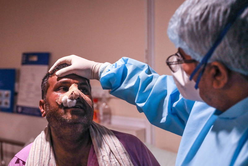 染疫人数激增的中东国家阿曼出现「毛霉菌症」病例，是阿拉伯半岛首起已知病例。图为印度「毛霉菌症」患者。（欧新社）(photo:LTN)