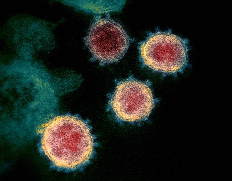 美国全体情报机构近日针对武汉肺炎病毒源头提出报告，但遭诟病内容毫无突破。（美联社档案照）(photo:LTN)