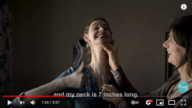 柳德米拉罹患罕见疾病，光脖子就长18公分。（图取自YouTube频道truly）(photo:LTN)