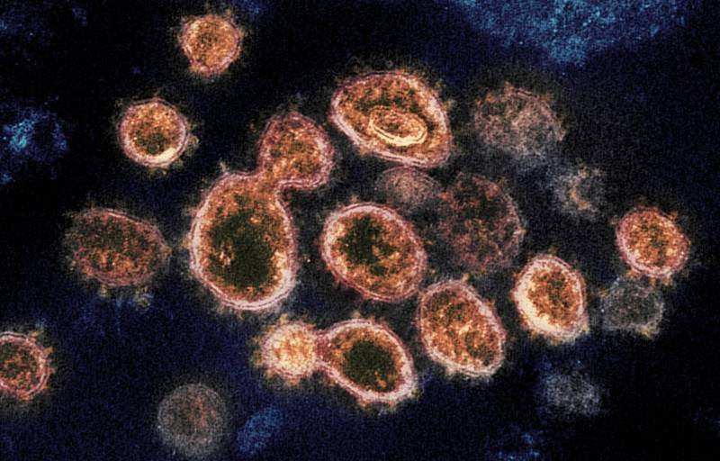 武肺病毒出现多种变异株，R.1变种在全球已有1万多起病例。图为电子显微镜下的武肺病毒。（美联社）(photo:LTN)
