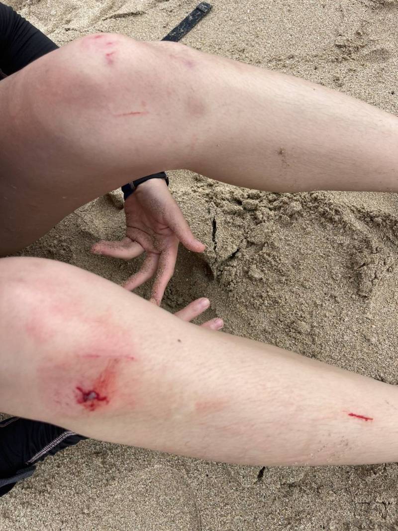 1名遊客膝蓋出現擦挫傷。（威鯨救難隊提供）