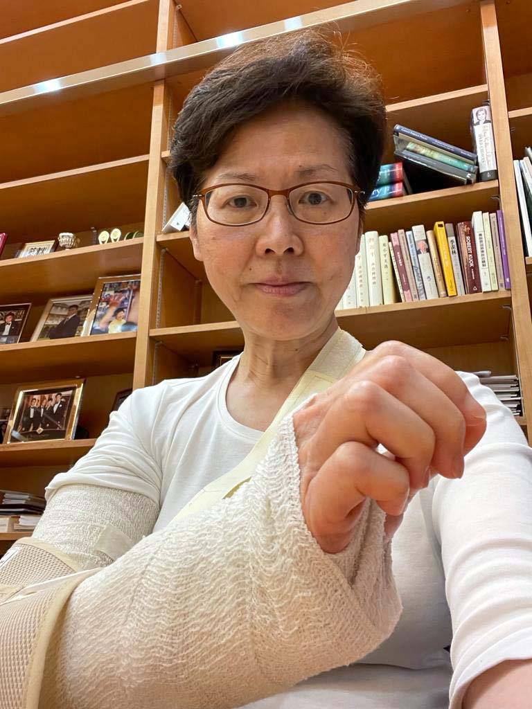 林郑月娥今傍晚在脸书分享自己右手包石膏的照片。（图翻摄自林郑月娥脸书）(photo:LTN)