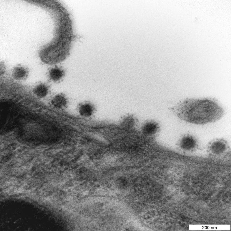 电子显微镜下的Delta变种病毒真实样貌。（取自俄罗斯VECTOR中心官网）(photo:LTN)