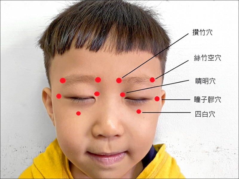 搶救兒童近視中醫針藥來救援 即時新聞 自由健康網