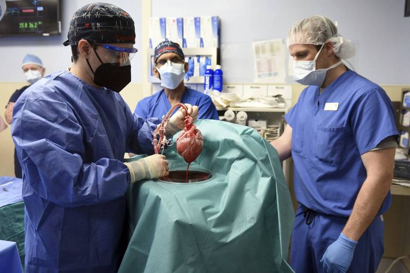 此次手术使用的是经过基因编辑的猪心，以降低器官排斥反应。（美联社）(photo:LTN)
