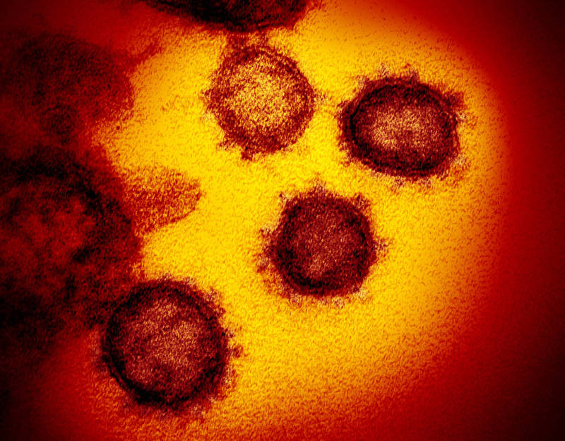 電子顯微鏡下所見的新型冠狀病毒。（美聯社檔案照）