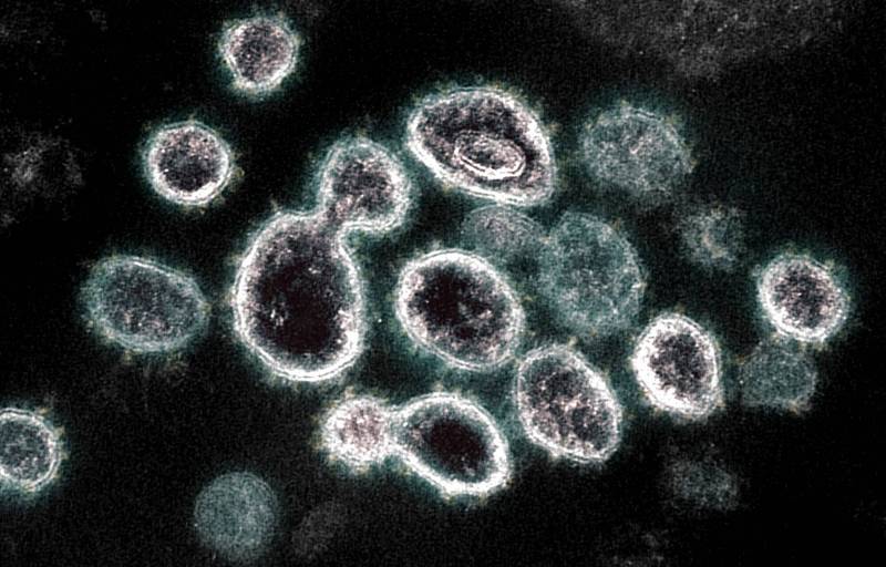 电子显微镜下的新型冠状病毒。（法新社档案照）(photo:LTN)