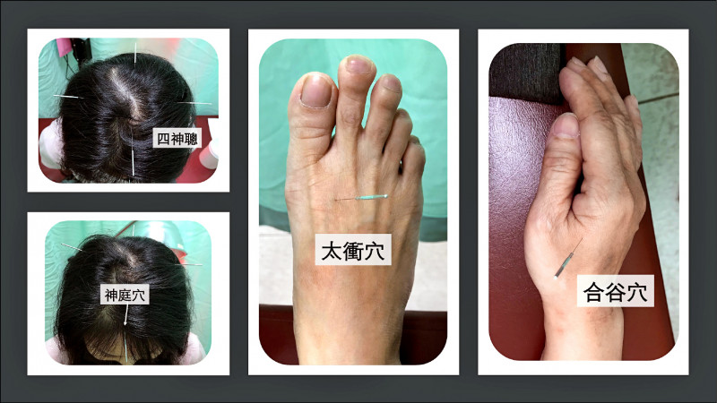 長年焦慮失眠中醫出手甩安眠藥 自由健康網