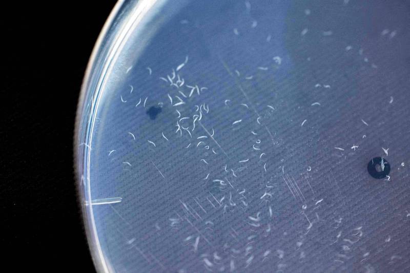 科学家利用秀丽隐桿线虫独爱癌细胞「气味」的特性，开发出一种特殊的承载晶片。（法新社）(photo:LTN)