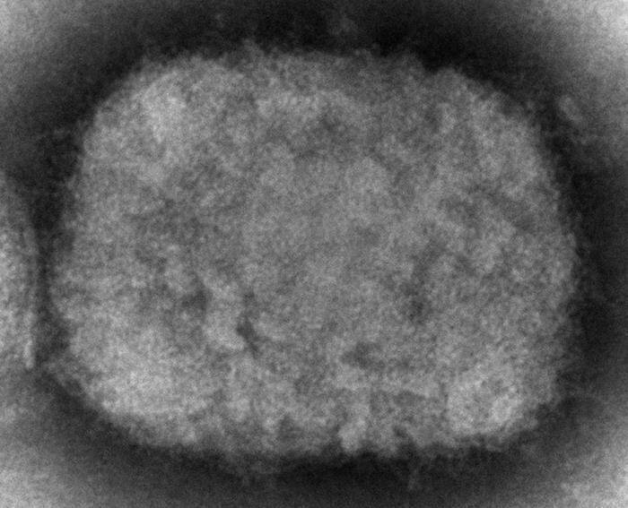 电子显微镜呈现2003年美国猴痘疫情的病毒样本。（美联社档案照）(photo:LTN)