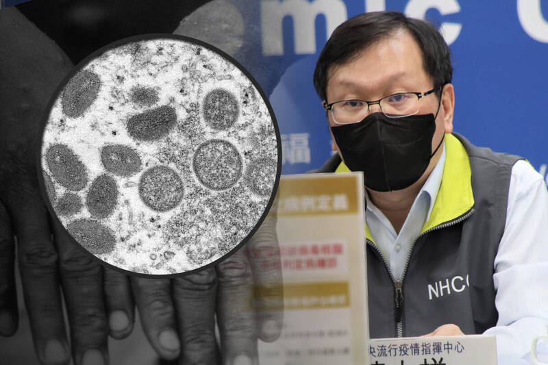 疾管署發言人莊人祥今天表示，是否將猴痘列為法定傳染病正在簽核中，可能今天或明天就會列入。（指揮中心、美聯社，本報合成）