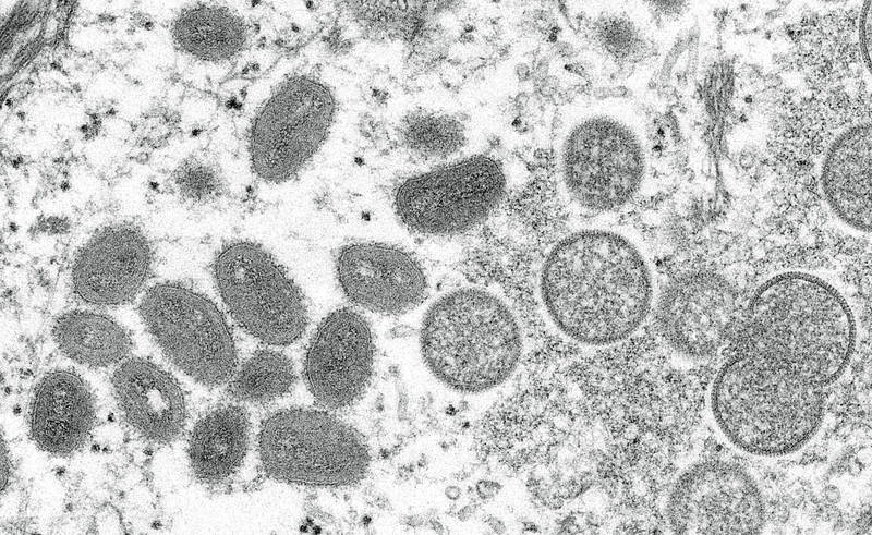 
An electron microscopic （EM） image shows mature, oval-shaped monkeypox virus particles as well as crescents and spherical particles of immature virions, obtained from a clinical human skin sample associated with the 2003 prairie dog outbreak in this undated image obtained by Reuters on May 18, 2022.
Photo: Reuters