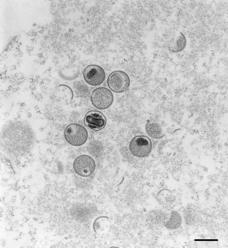 疾病管制署昨天晚間公布國內第一起猴痘確診病例，是一名20多歲、從德國返台的本國籍男性，今天更新匡列接觸者人數達20人。圖為電子顯微鏡下的猴痘病毒。（法新社檔案照）