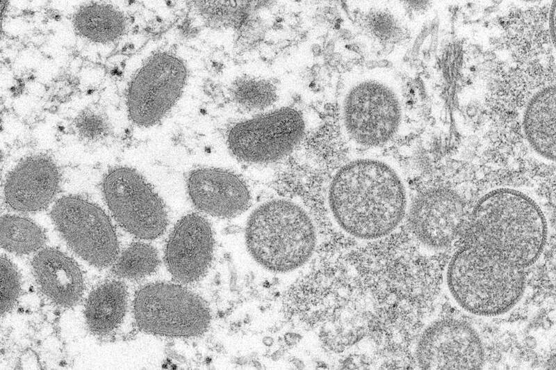 世界衛生組織（WHO）指出，猴痘已在超過50國擴散，不過WHO秘書長譚德塞宣布，目前尚未構成全球公共衛生緊急事件。圖為在電子顯微鏡下的猴痘病毒。（美聯社）
