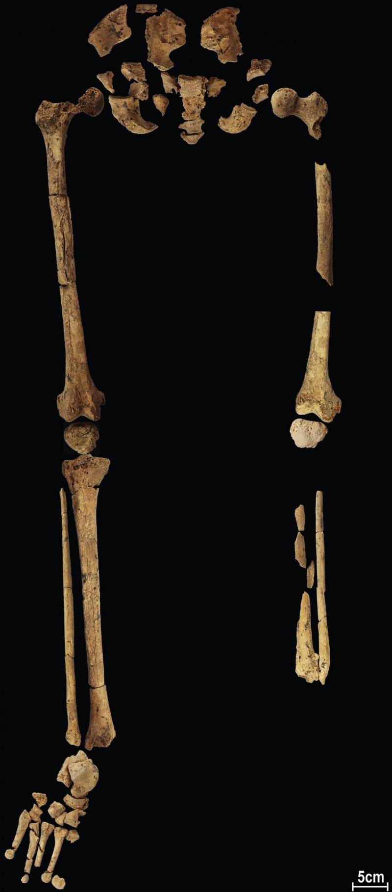 2020年在印尼婆罗洲一处偏远洞穴中发现一具3万1000年历史人类骸骨，失去左腿下半部，科学家7日公布，认为这是已知最早的截肢手术证据，已改写古代医学历史。（美联社）(photo:LTN)