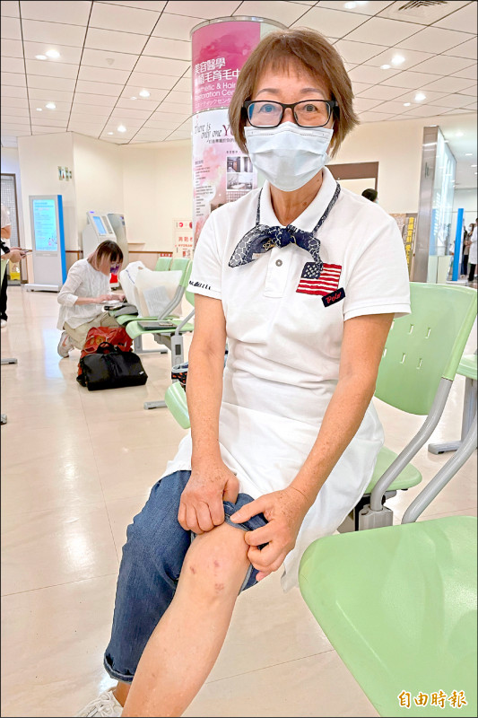 膝關節軟骨缺損及早修補免換膝 即時新聞 自由健康網 膝關節軟骨缺損及早修補免換膝 即時新聞 自由健康網